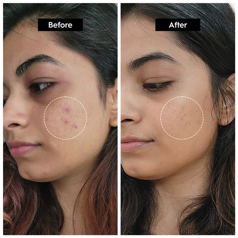Radiant Reset| Externaglow Niacinamide Serum 10% + Zinc 1%